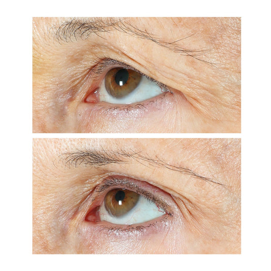 StriVectin eye serum bottle for eyelids and under eyes