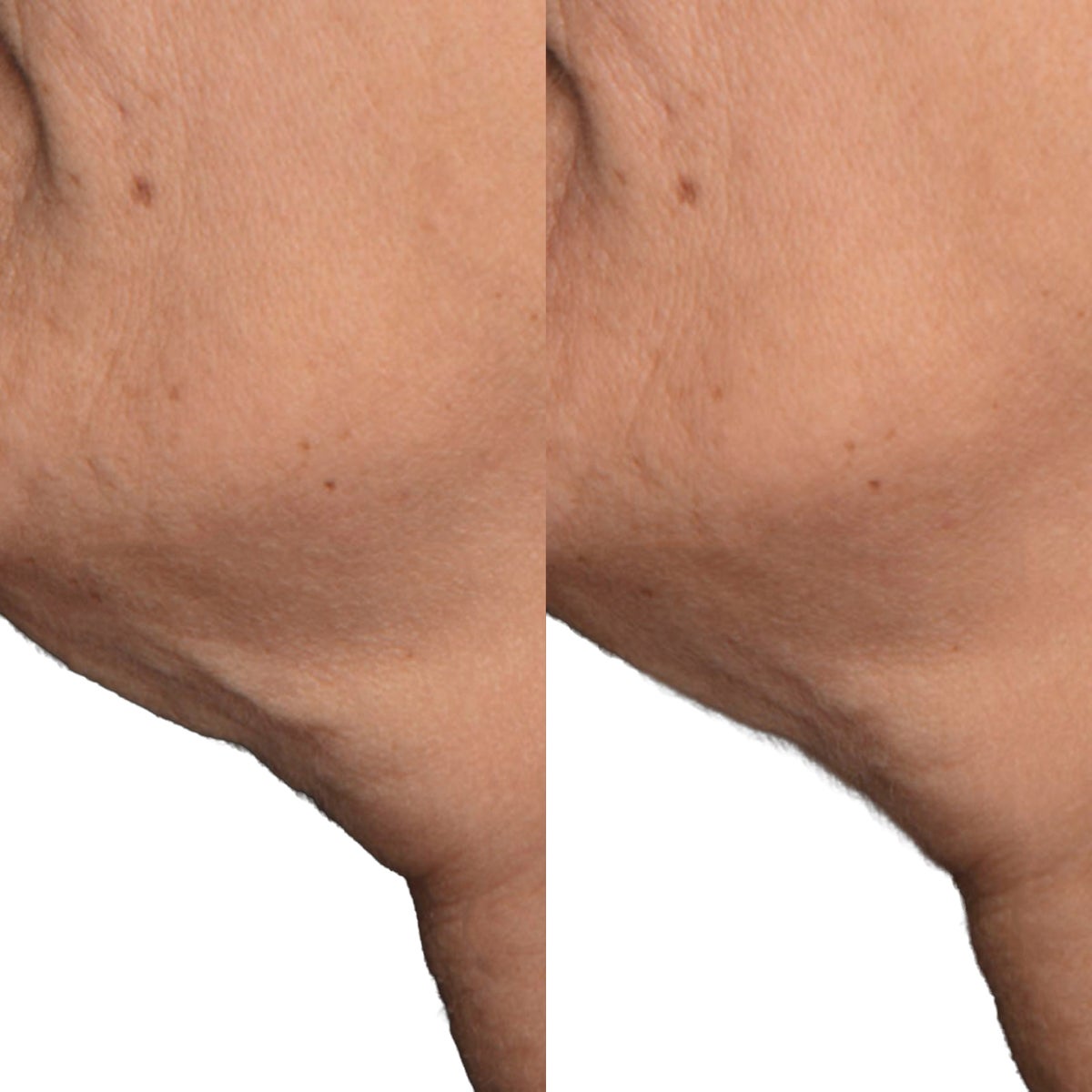 Dr. Brandt neck tightening cream packaging