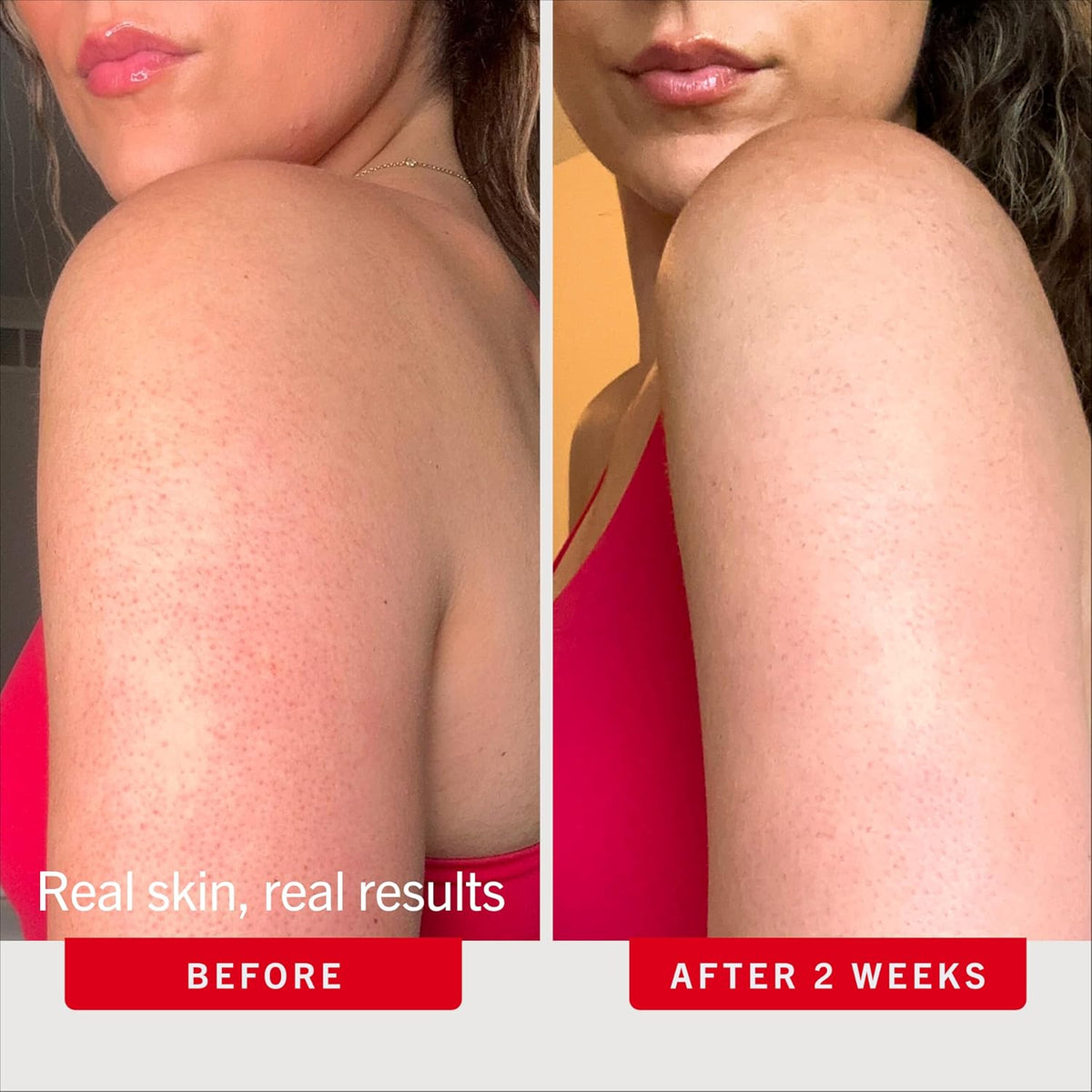 KP Bump Eraser exfoliating scrub for body care