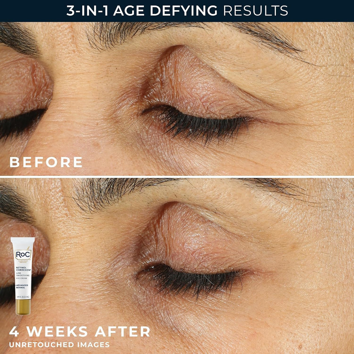 RoC Retinol Correxion dermatologist-tested value duo