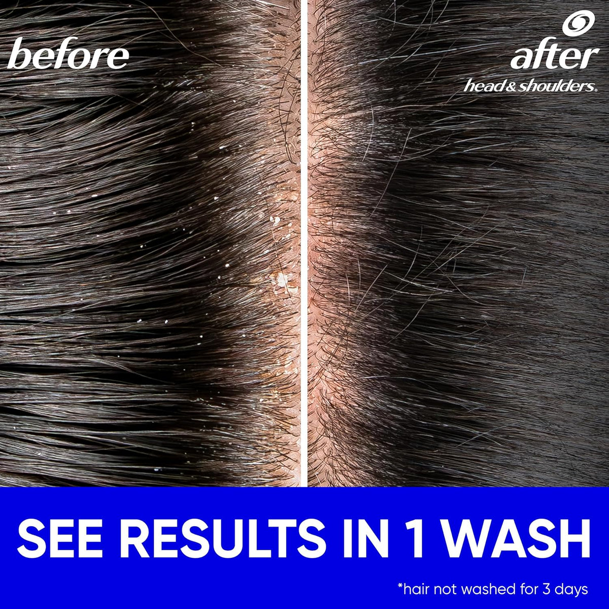 Value-size Head & Shoulders Classic Clean shampoo