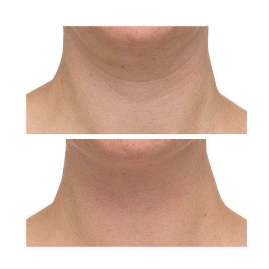 StriVectin advanced tightening neck cream jar