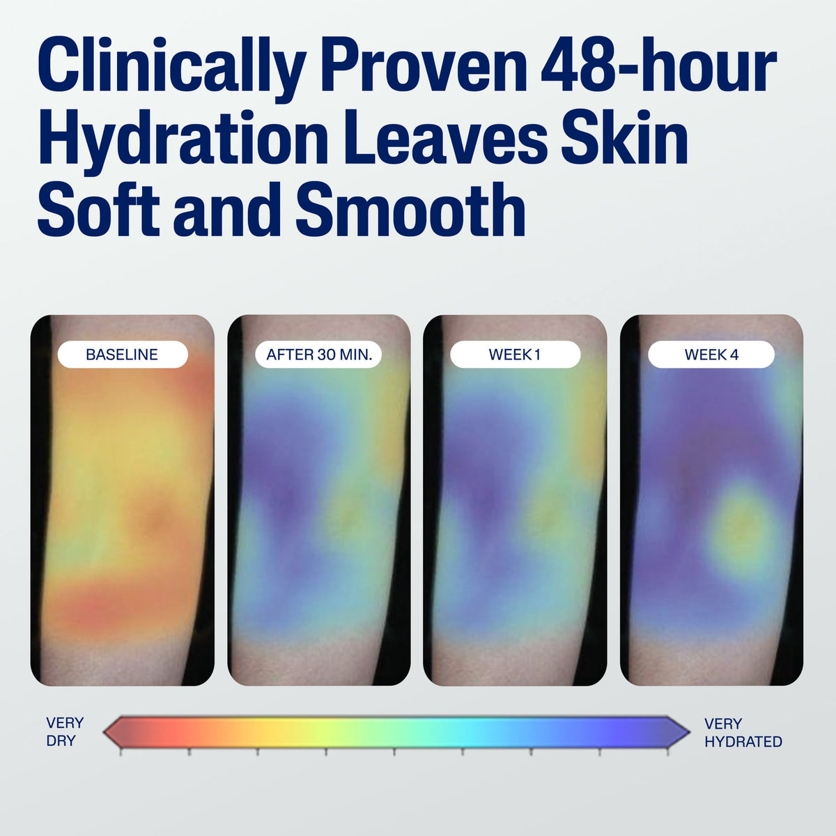 Cetaphil lightweight moisturizing body lotion