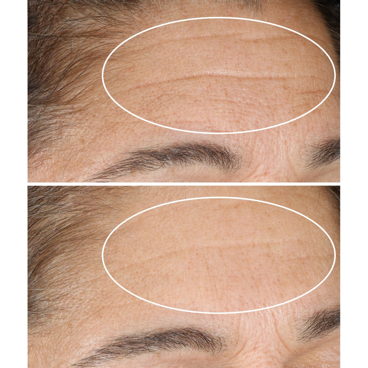 Nightly renewal moisturizer for fine lines and wrinkles