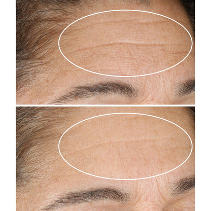 Nightly renewal moisturizer for fine lines and wrinkles