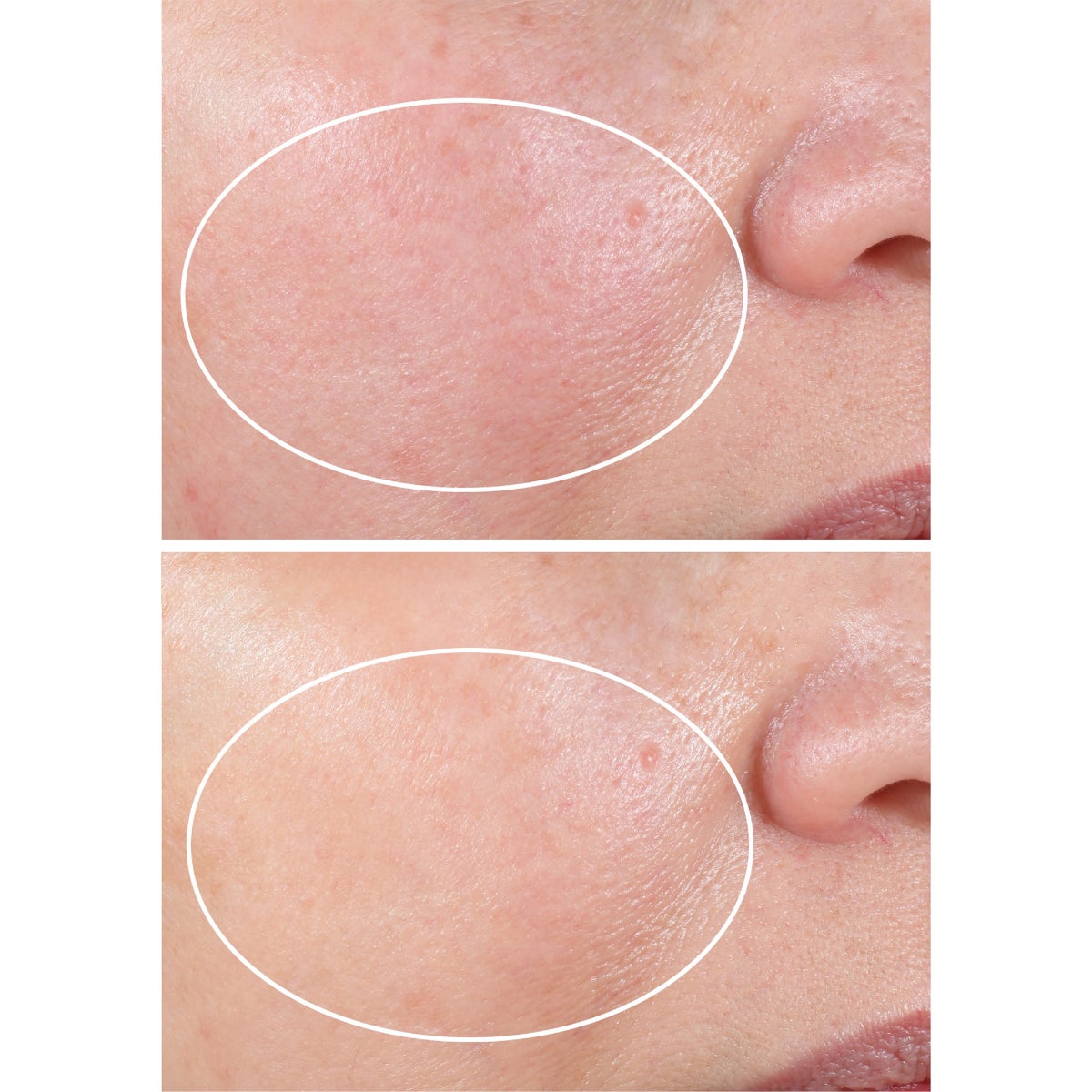 StriVectin moisturizer duo for dry skin care