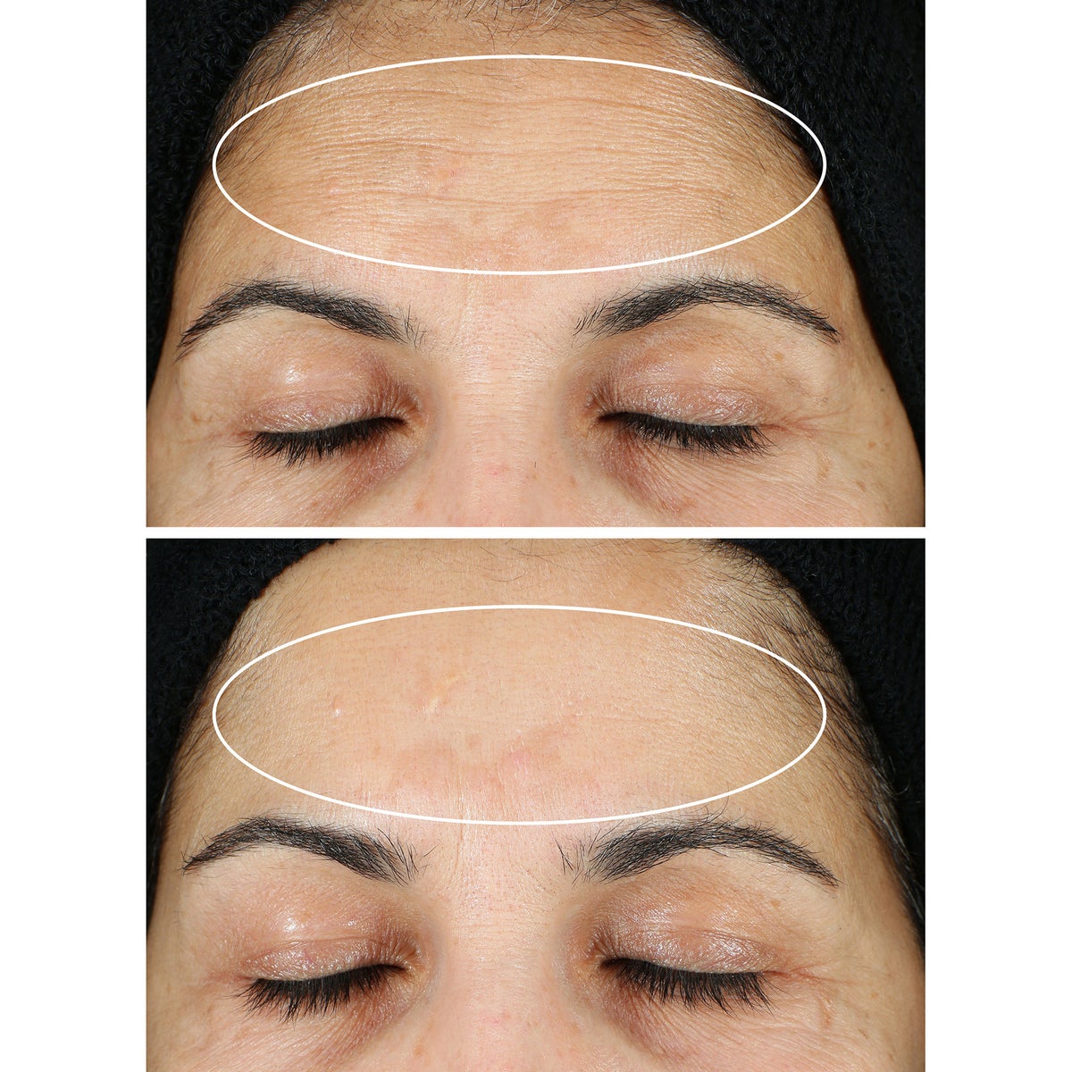 StriVectin serum set for brighter-looking skin