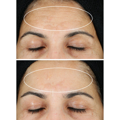 StriVectin serum set for brighter-looking skin