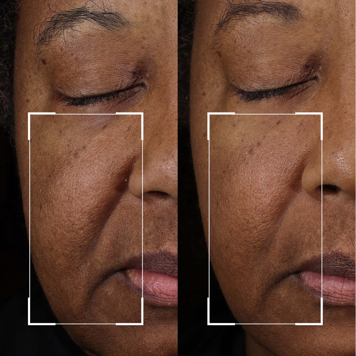 Premium StriVectin skincare serum for lifting and toning