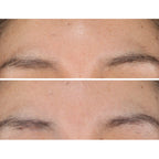 StriVectin pads designed to brighten skin