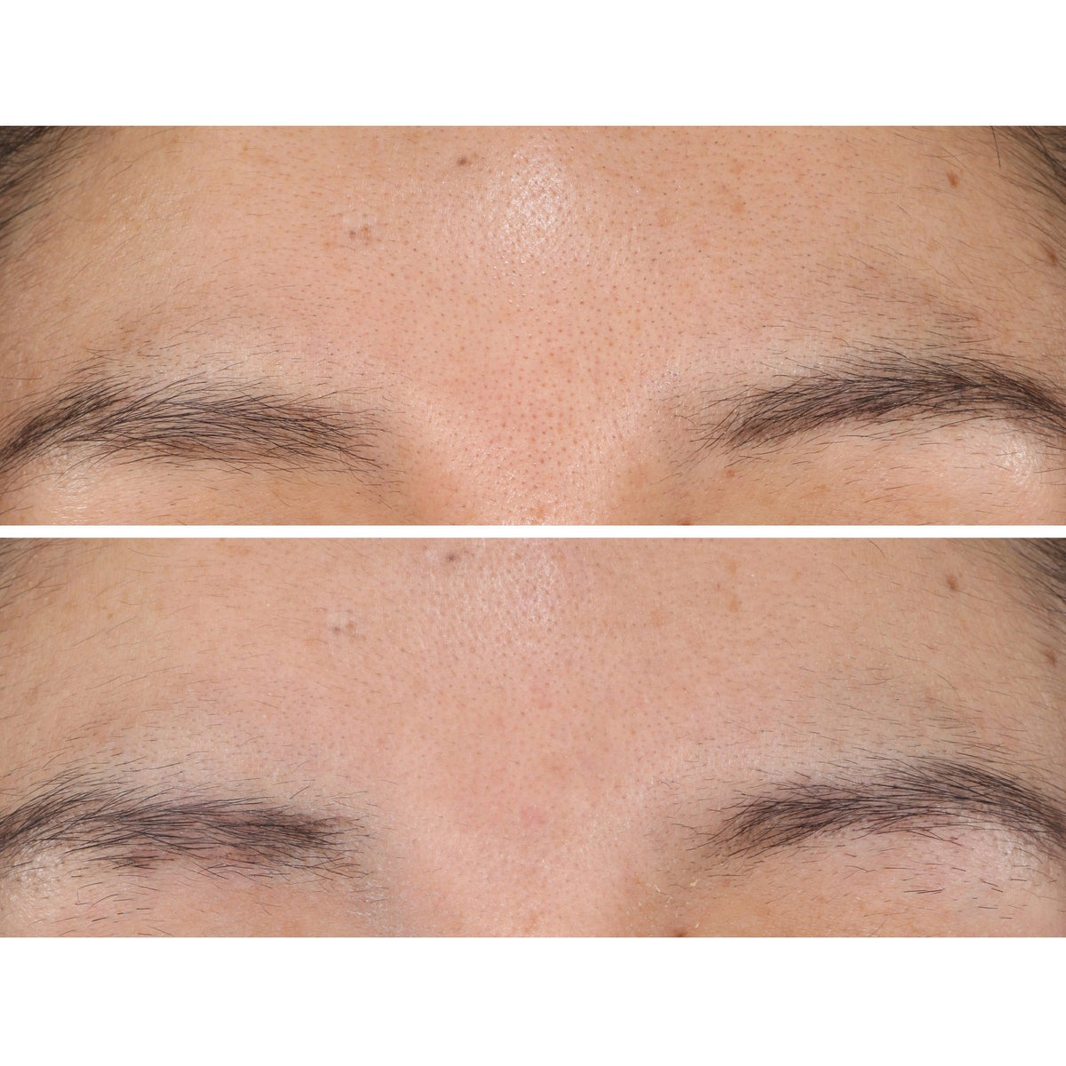 StriVectin pads designed to brighten skin