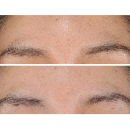 StriVectin pads designed to brighten skin