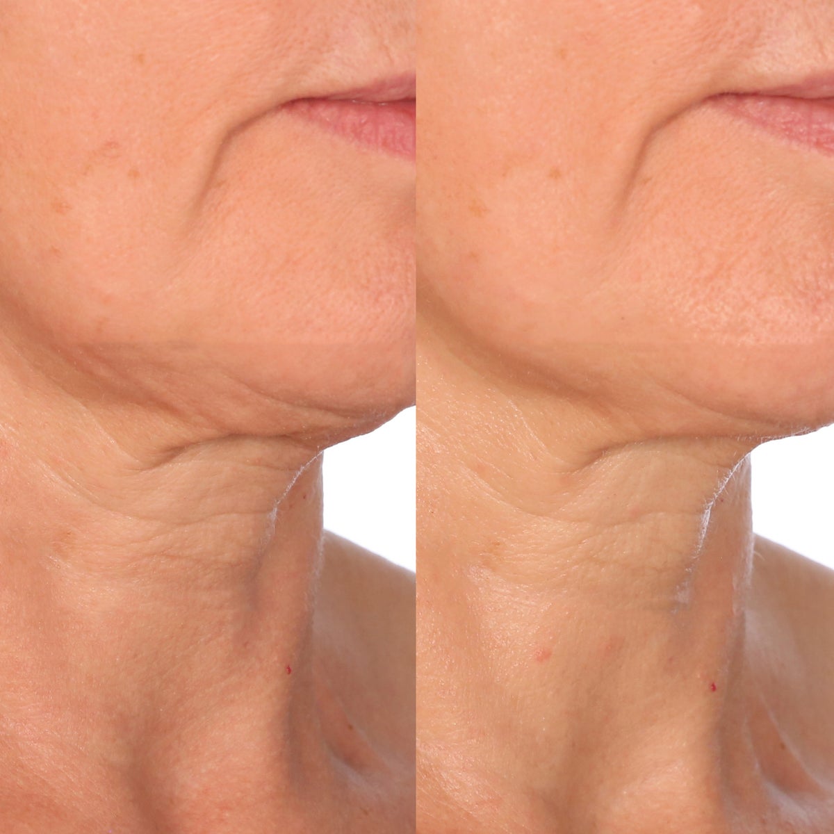 Dr. Brandt skincare product with included gua sha tool