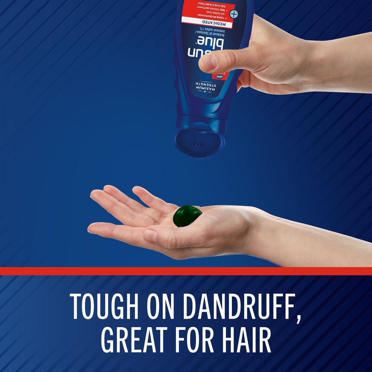 Selsun Blue scalp care shampoo for flakes and itch