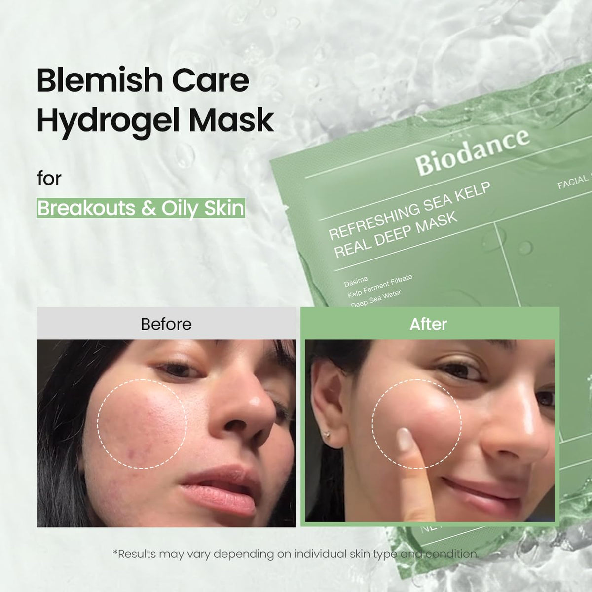 BIODANCE sea kelp facial treatment mask set