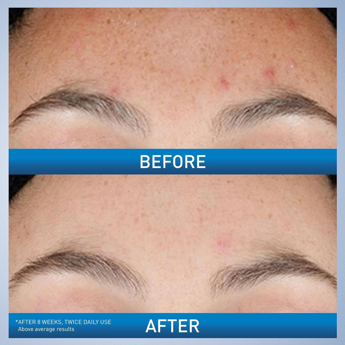 CeraVe resurfacing serum for visible pores