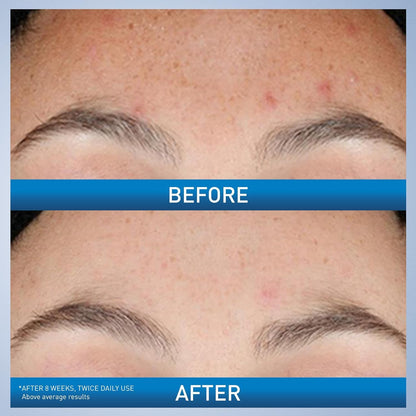 CeraVe resurfacing serum for visible pores