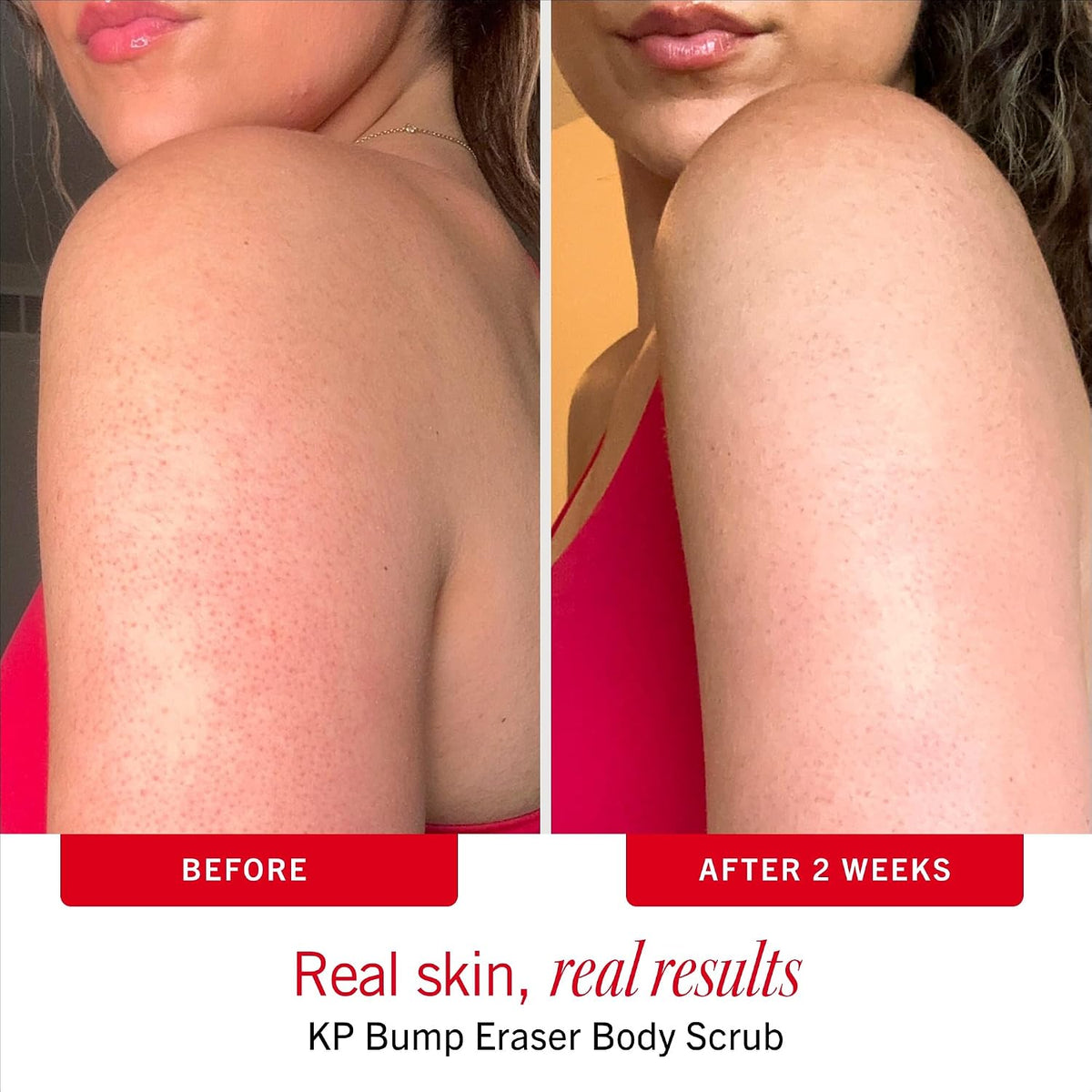 First Aid Beauty body scrub skincare product