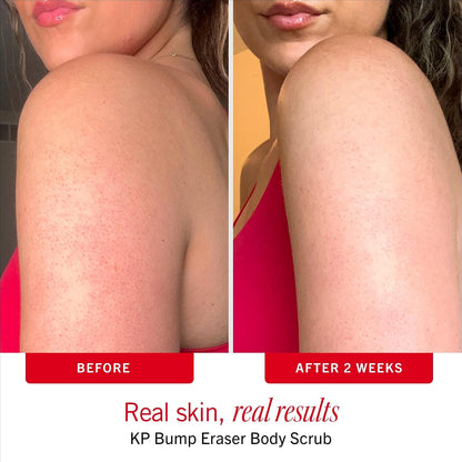 First Aid Beauty body scrub skincare product