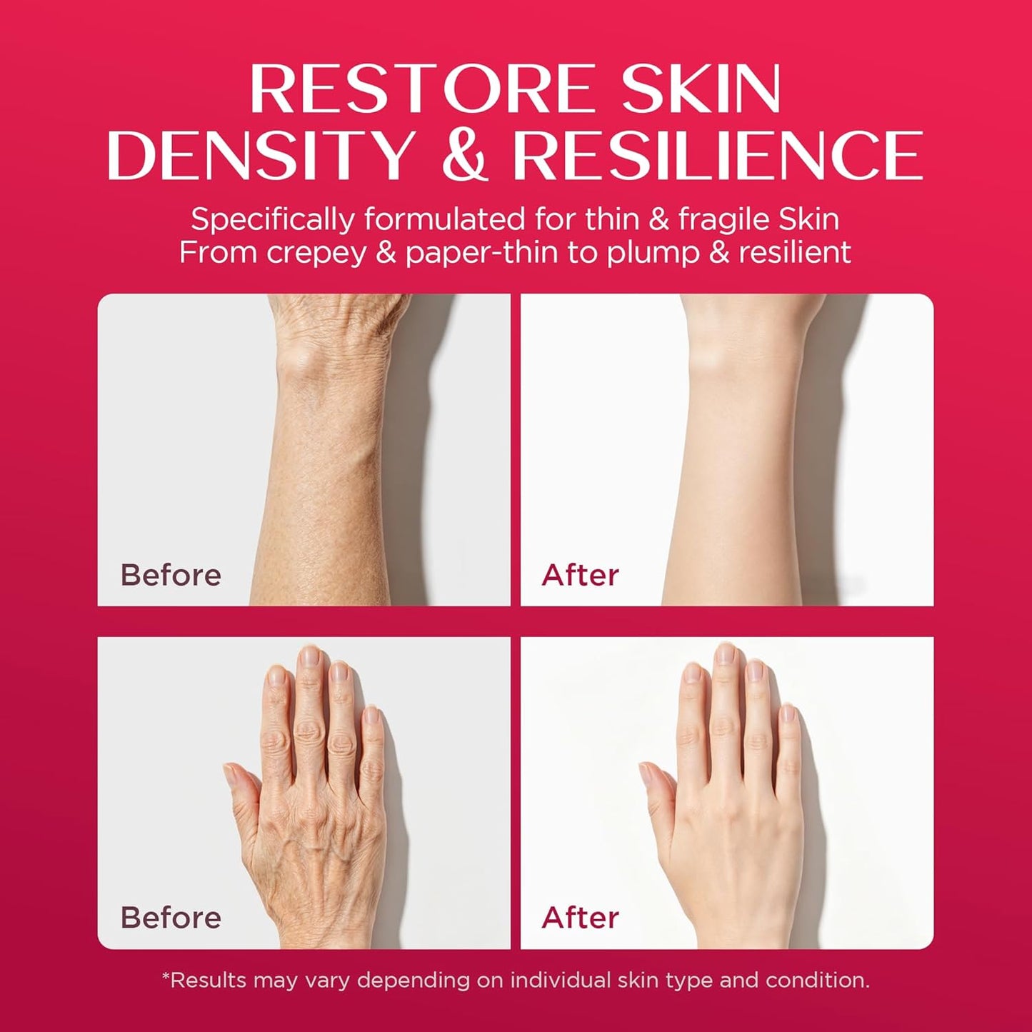 Visit the Vigority Store — Vigority Calendula Cream: Soothes Calendula Cream for Mature, Thin & Fragile Skin with Helichrysum, Bakuchiol & CICA - Hydrates, Nourishes & Strengthens Skin Barrier - Non-greasy Fragrance Free 3.4oz