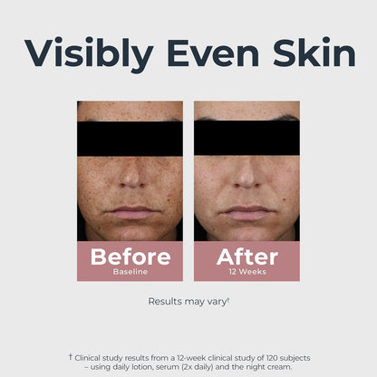 Lightweight Eucerin facial serum for dark spots