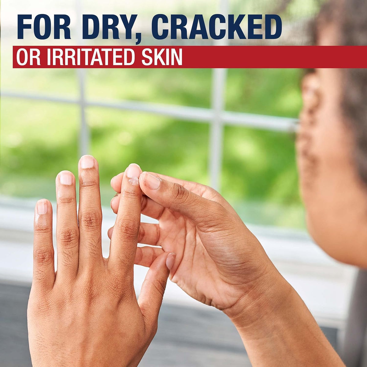 Aquaphor Advanced Therapy skin protectant