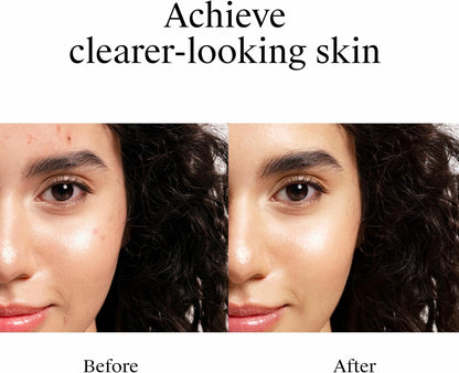 Neutrogena targeted blemish control gel for face
