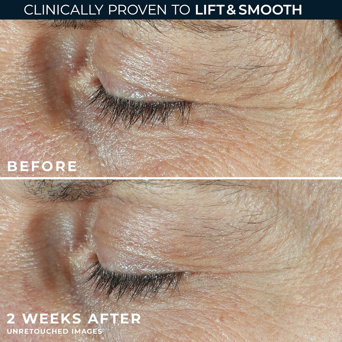 RoC Dual Eye Cream with white under-eye cream