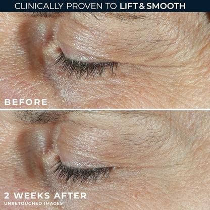 RoC Dual Eye Cream with white under-eye cream