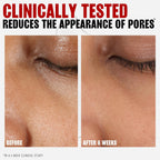 THAYERS witch hazel toner for daily skin prep