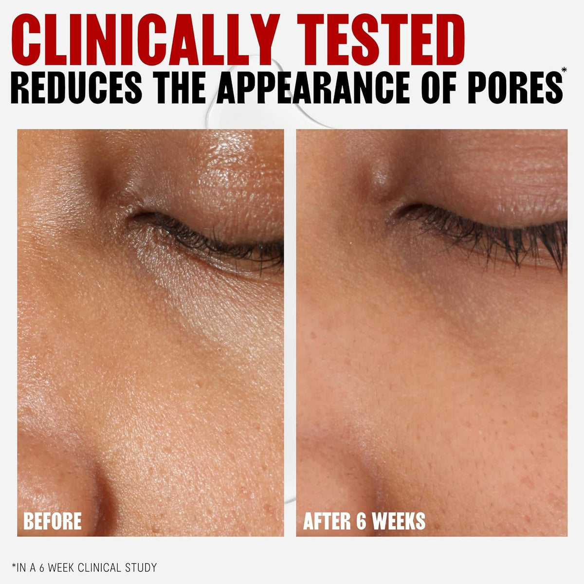 THAYERS witch hazel toner for daily skin prep