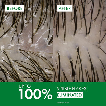 VICHY Dercos shampoo for color-treated hair