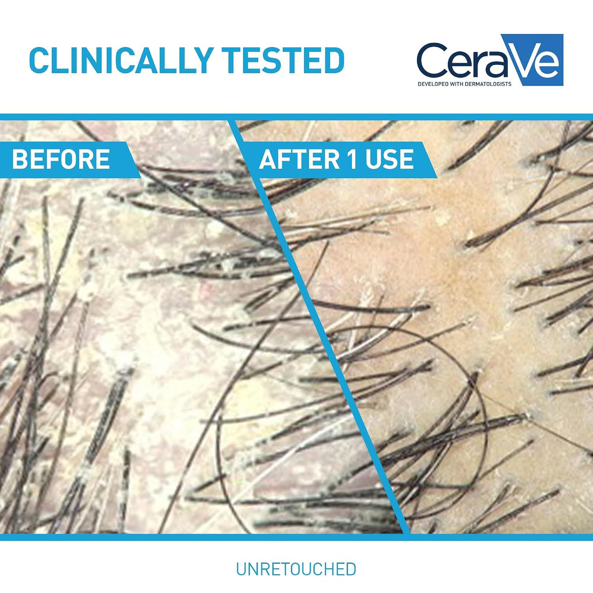 CeraVe dandruff shampoo for sensitive scalp and soft hair