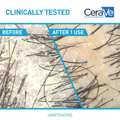 CeraVe dandruff shampoo for sensitive scalp and soft hair