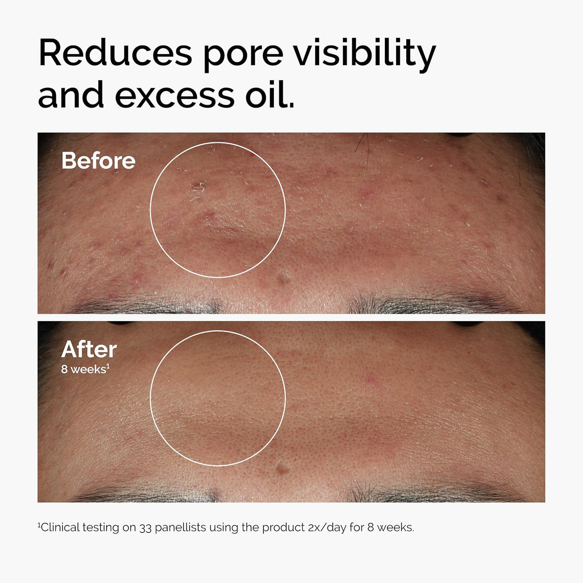 The Ordinary smoothing face serum packaging