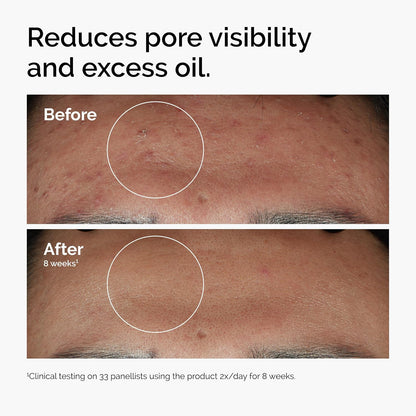 The Ordinary smoothing face serum packaging
