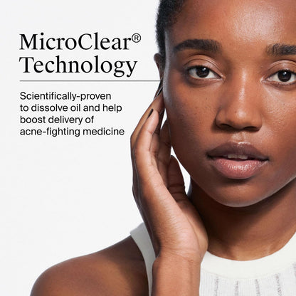 Pre-moistened acne treatment pads for face and body
