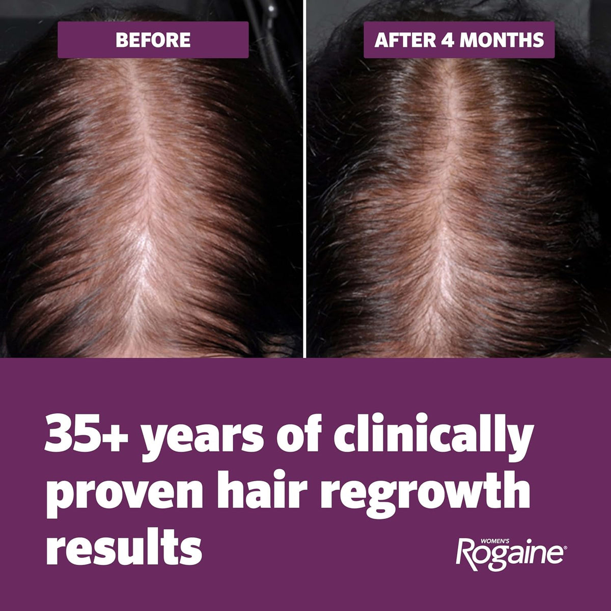 Rogaine 5% minoxidil foam 2.11 oz twin pack