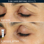 RoC Retinol Correxion dermatologist-tested value duo