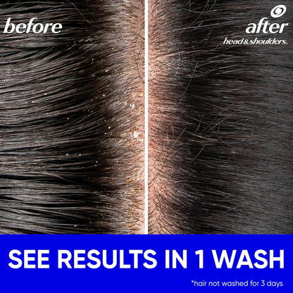 Value-size Head & Shoulders Classic Clean shampoo