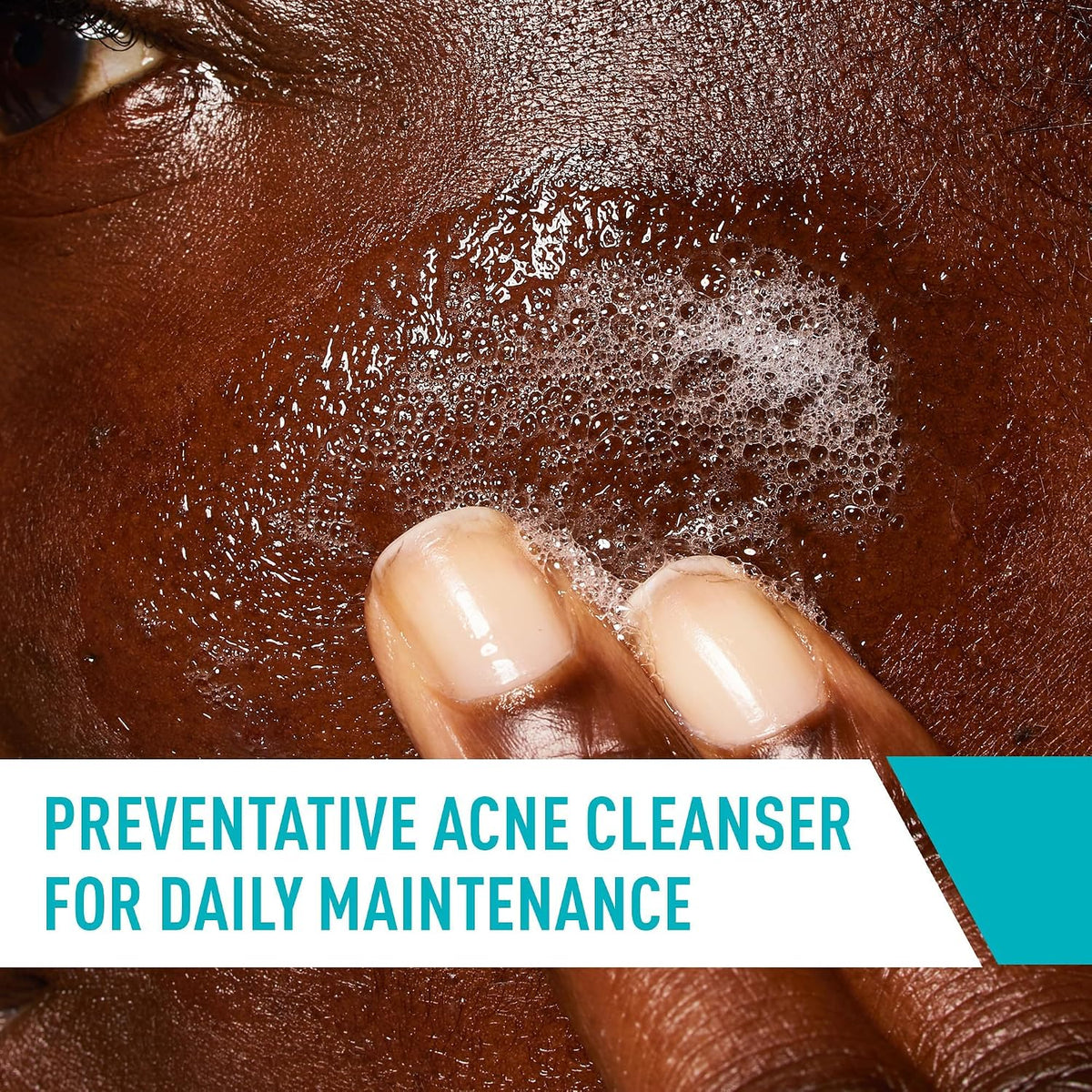 CeraVe fragrance-free acne cleanser 8 oz