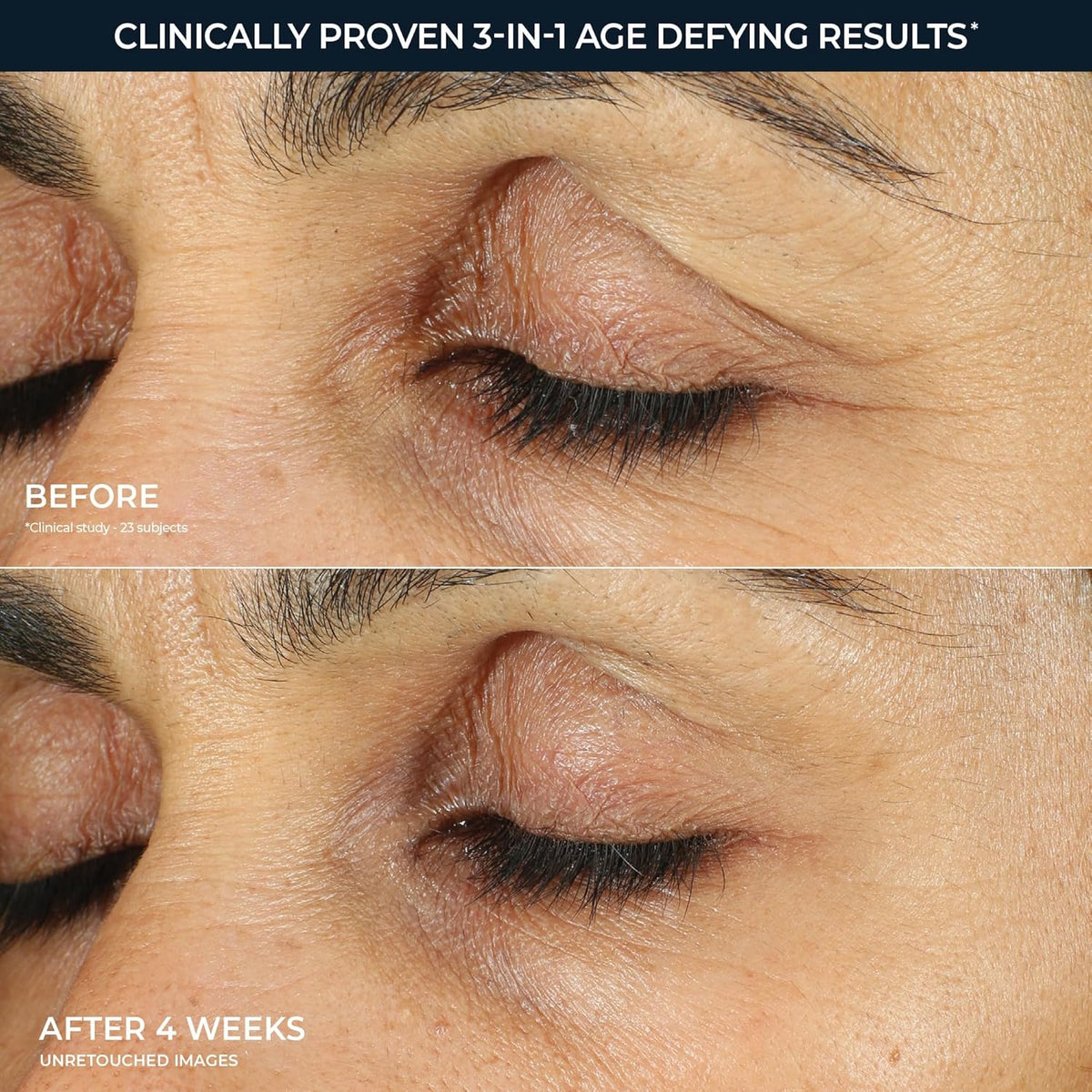 Dermatologist-tested RoC retinol eye cream